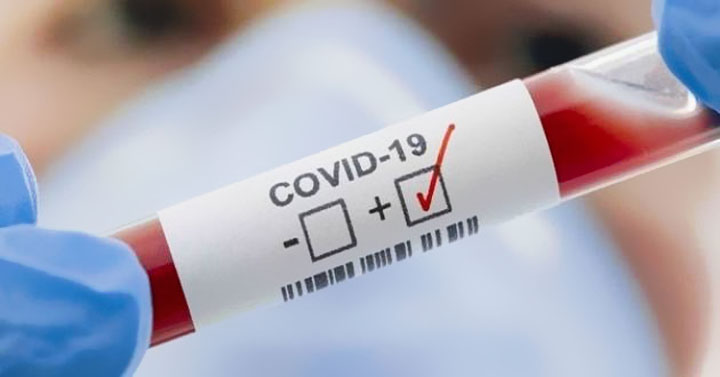 Covid-19: gestione casi congiunti